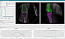 DSX – Dynamic Stereoscopic X-Ray